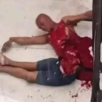 He Never Expected That: Ripped In Halves Suicider Is Still Alive & Suffering