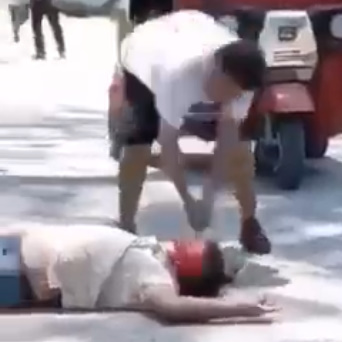 DAMN: The Official Psychopath Of The Week