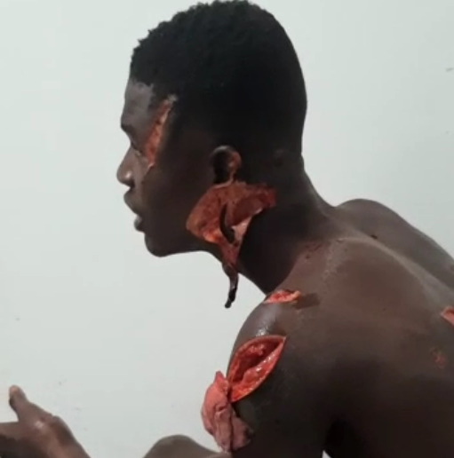 Hacked With Machete Man Calmly Falls Apart