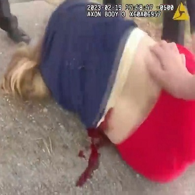 Woman Gets Shot After Pointing Gun at Officers As She Approached Them