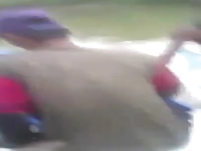 Kid was attacked by cocodile