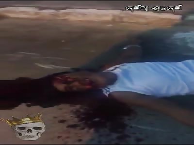 Bike accident cracked head 