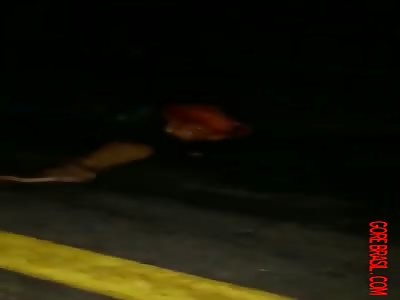 Body parts after accident 