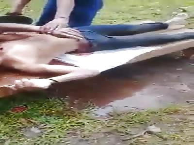 Injured man getting help 