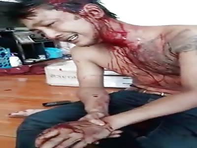Asian guy injured bleeding 
