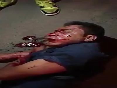 Bleeding Mexican grease balls 