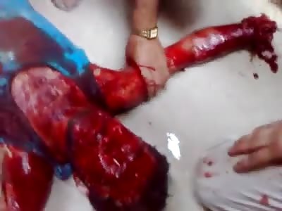 Bloody guy half dead 