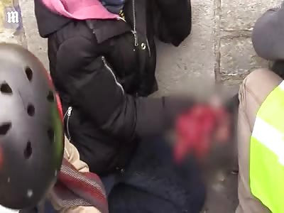 Moments after protesters hand is 'blown off by grenade'