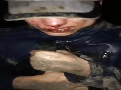 ELECTROSHOCK THERAPY , Tortured Over Drug Debt