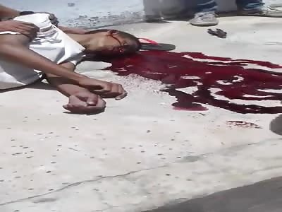 took an electric shock and fell off the pole