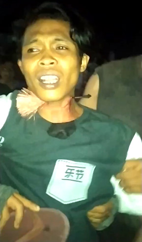 Hunting Accident Leaves Guy with Arrow in His Neck