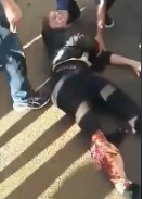 Hot Girl Has Her Leg Flayed