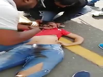 Woman victim of terrible accident 