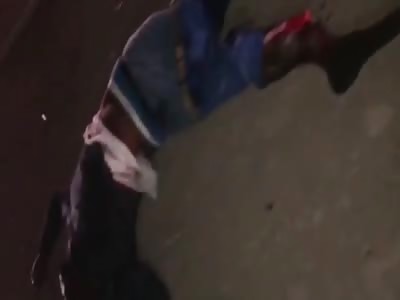 Losing a Leg in Accident