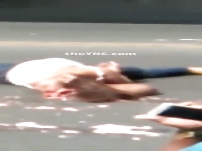 Accident Leaves Woman with Splitting Headache 