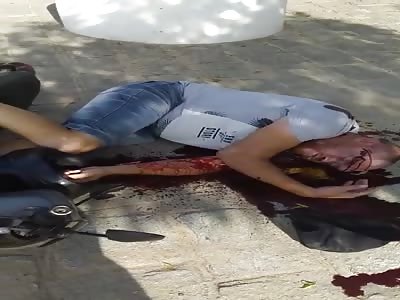 Headshot Leaves Man Leaking