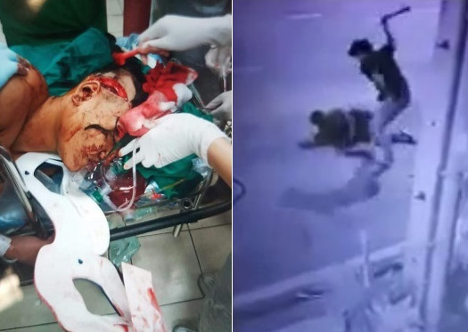 Man Ganged Up On With Machetes