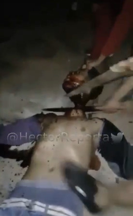 Assassins Use Hacksaws to Behead and Dismember Rival