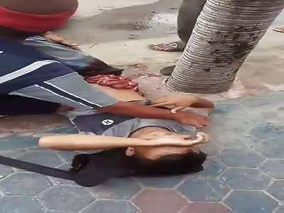 Man Disemboweled After Bike Accident