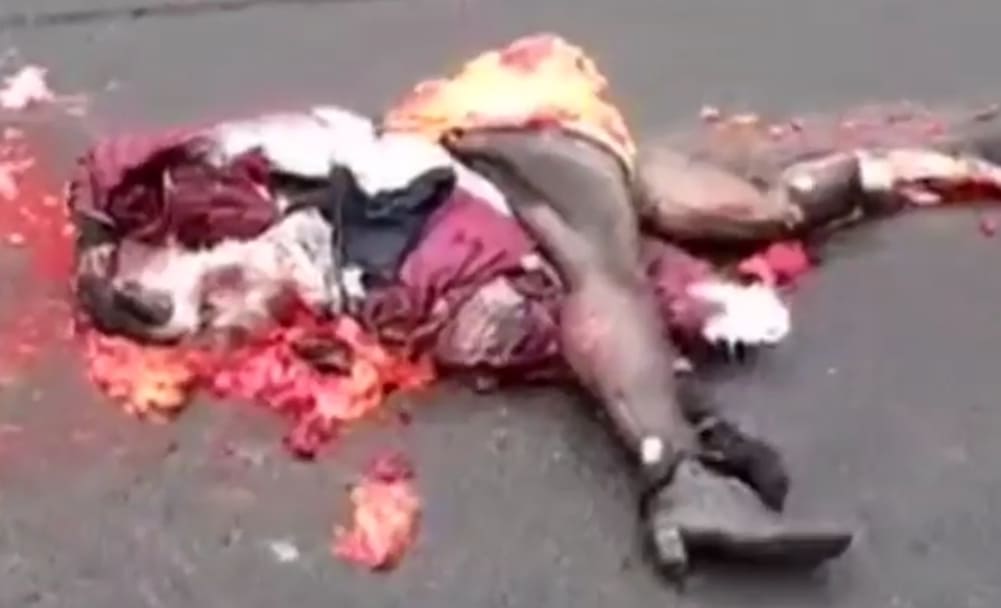 Woman Disfigured After Road Accident