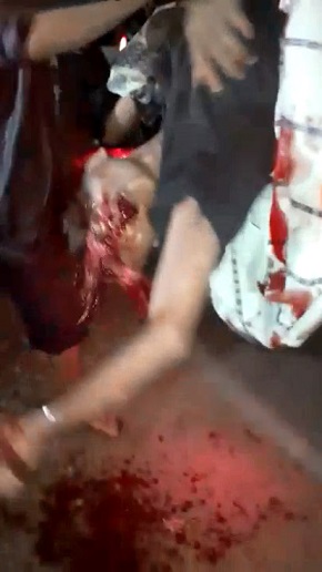 Closed Casket Funeral for This Man