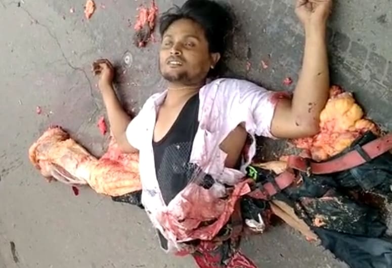 Accident Leaves Man Split in Half