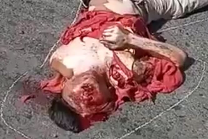 Skull Crushing Accident