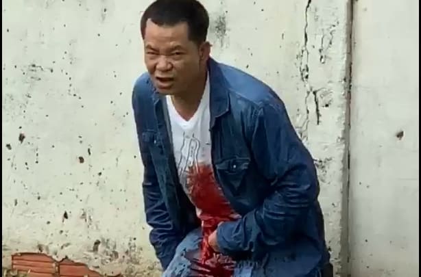 Mental Man Cuts Out His Intestines