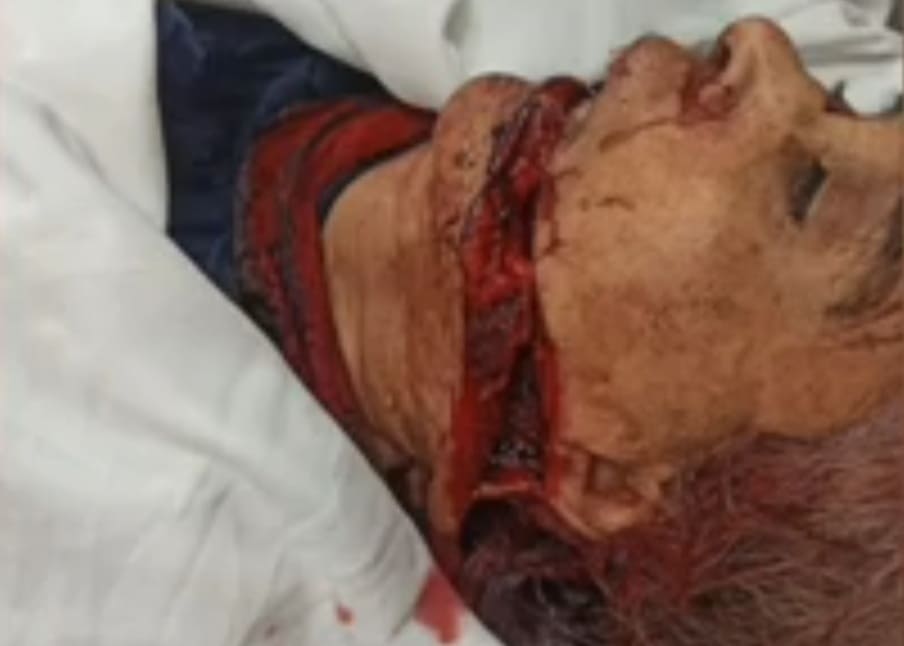 Elderly Woman Hacked to Death in Broad Daylight