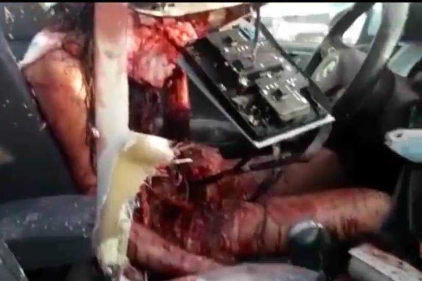 Woman in Beirut Torn to Shreds