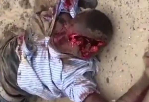 Biker With a Gnarly Hole in His Head