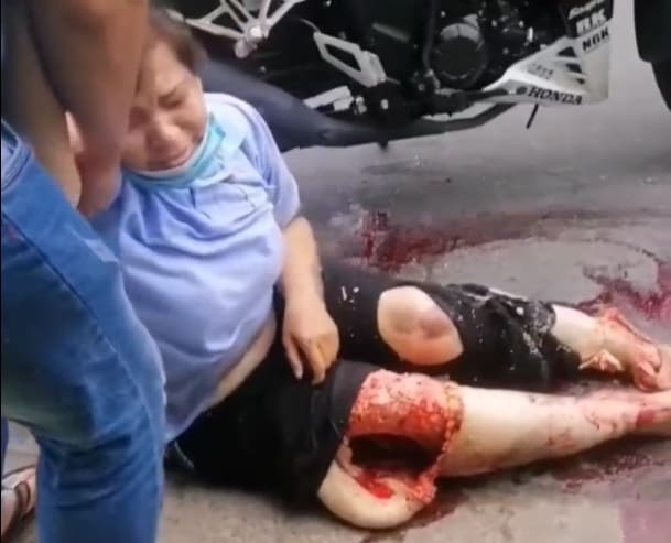 Some Serious Road Rash...