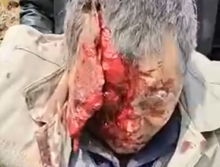 DAMN: Old Man's Face Damn Near Ripped Off 