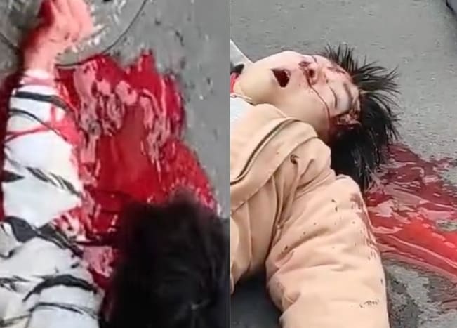 Why Helmets Are Important 