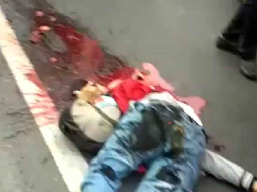 Biker Left Bloody and Mangled