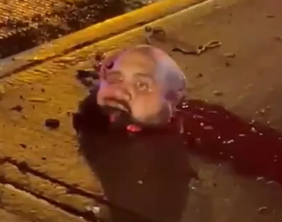 Bronx Man Decapitated By Train