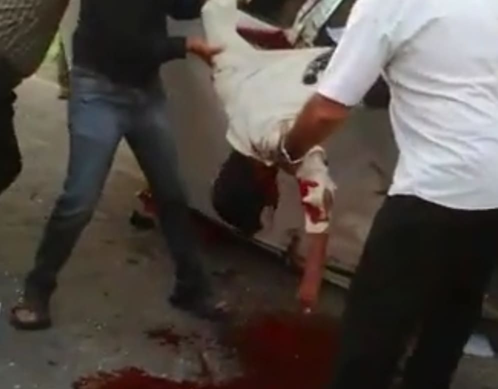 Dude Damn Near Decapitated In Accident