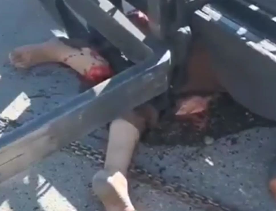 From Forklift Operator To Wheelchair Occupant