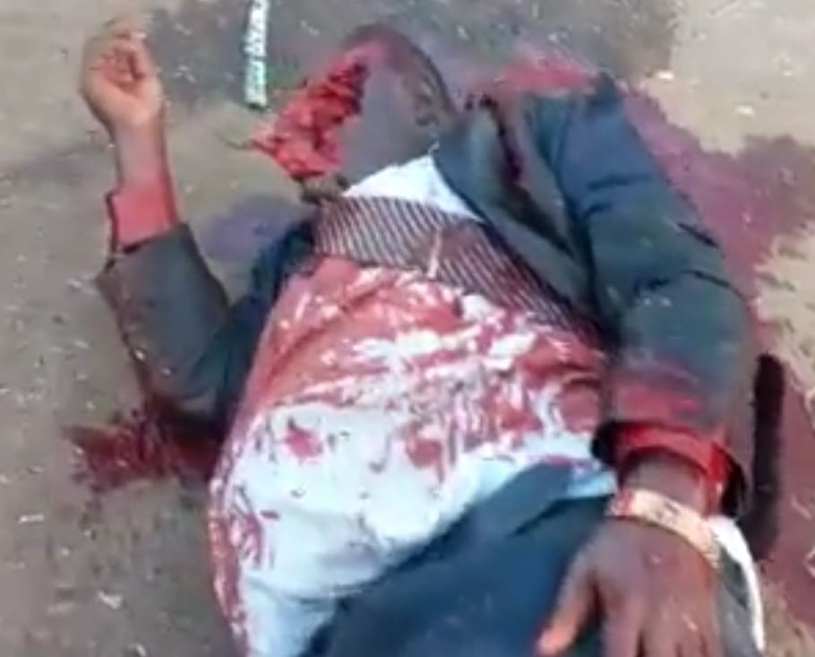 Still Alive With His Face Blown Off