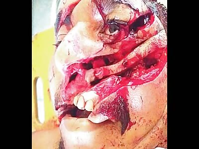 Last Moments After Brutal Machete Attack