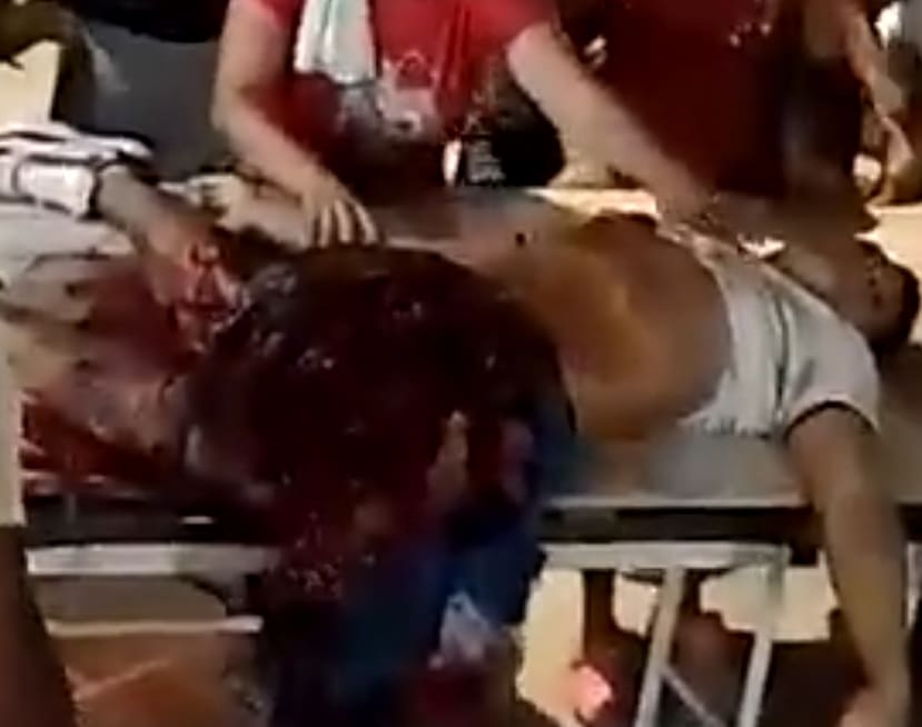 Throwing Explosives At Police Backfires