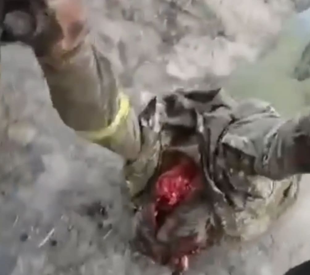 Aftermath At The Frontlines Of Russia/Ukraine War