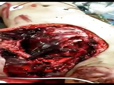 Heart Beating in Biker's Chest Apart