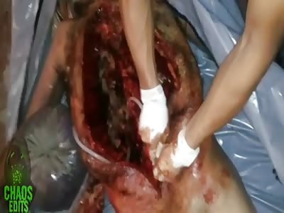 SLAUGHTER TO PREVAIL 