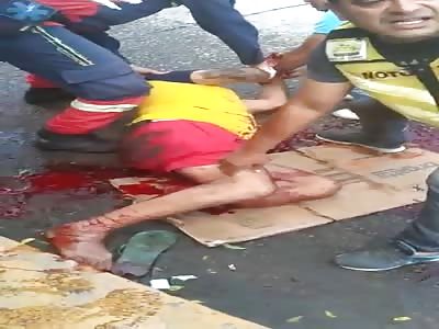 bloody fucked up leg