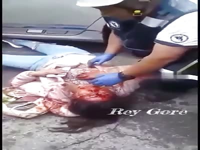 woman injured in accident 