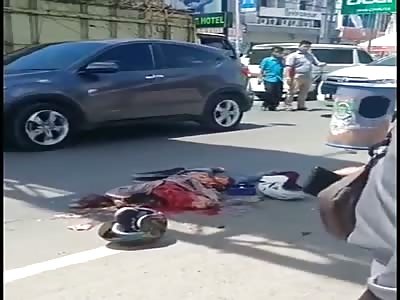 woman has her body torn in terrible accident