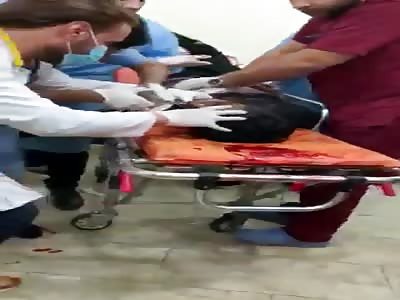 Extract a tear gas canister from the mouth 