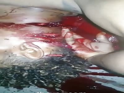 Man was murdered and have finger cut