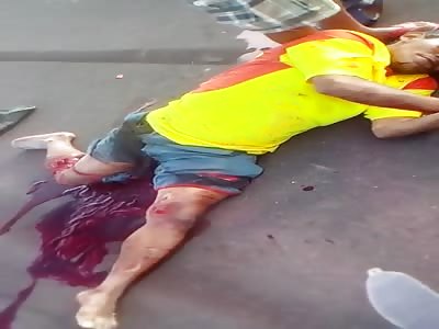 old man injuried after accident